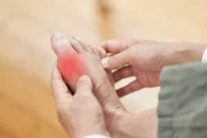 va disability rating for gout