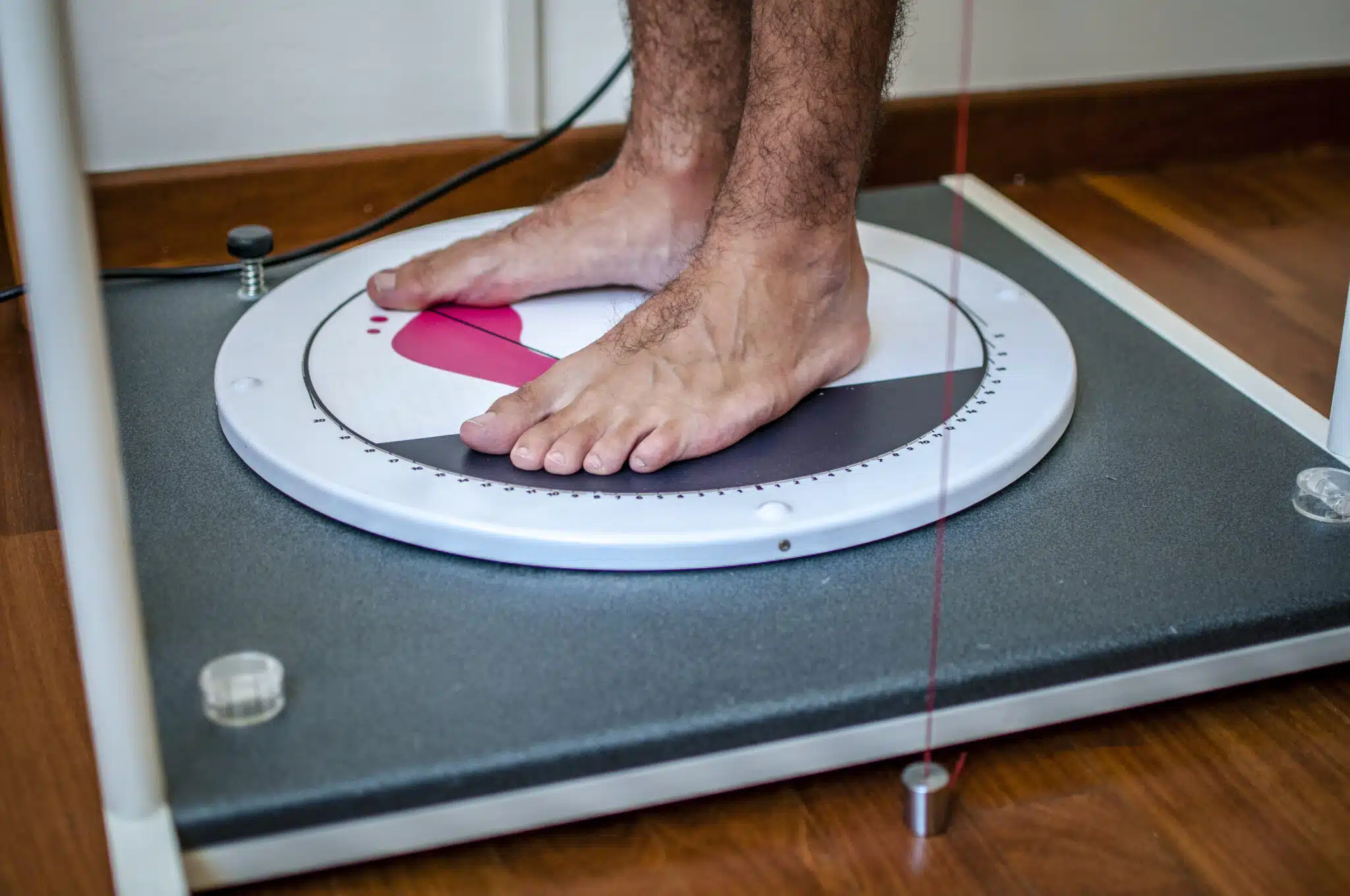 pes planus va rating