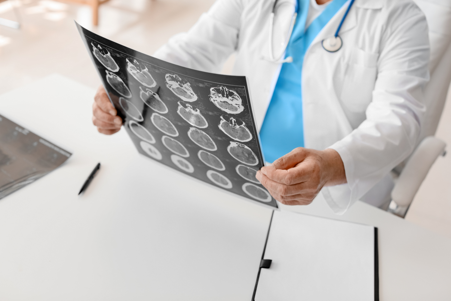 traumatic brain injury TBI VA rating