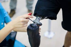 VA Disability Benefits for Amputation