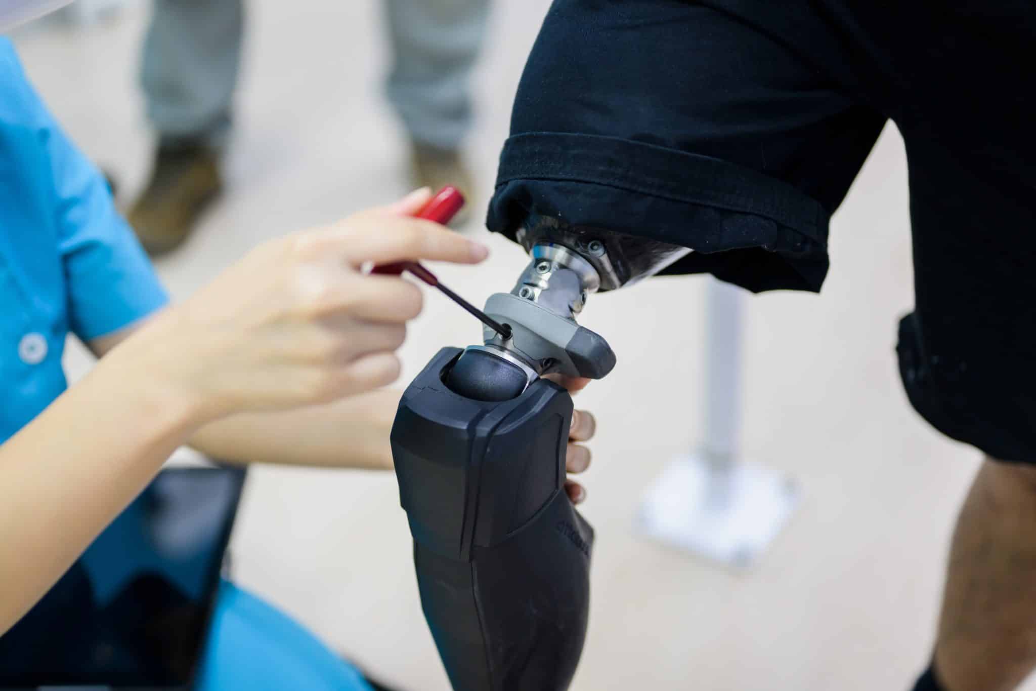 VA Disability Benefits for Amputation