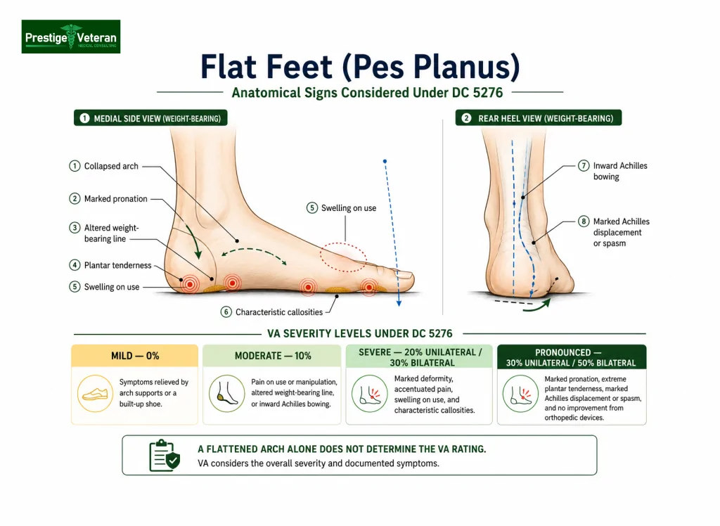 VA disability for flat feet (pes planus)